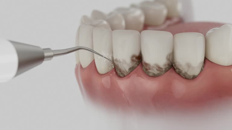 Trusted Root Canal Treatment service in Landis, NC - Dentist Open Now